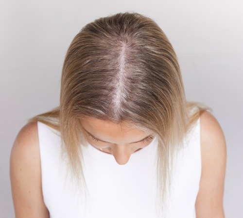 model without thickener before makeover